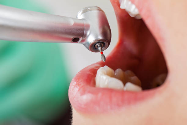 Best Emergency Denture Repair in Lake Worth, TX